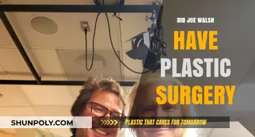 Joe Walsh's Transformation: Plastic Surgery Rumors and Reality Revealed