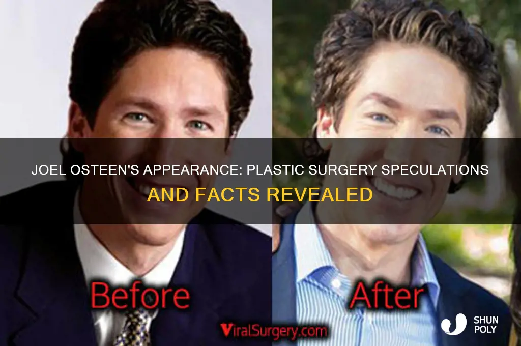 did joel olsteen have plastic surgery
