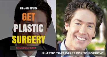 Joel Osteen Plastic Surgery: Fact or Fiction? Unveiling the Truth