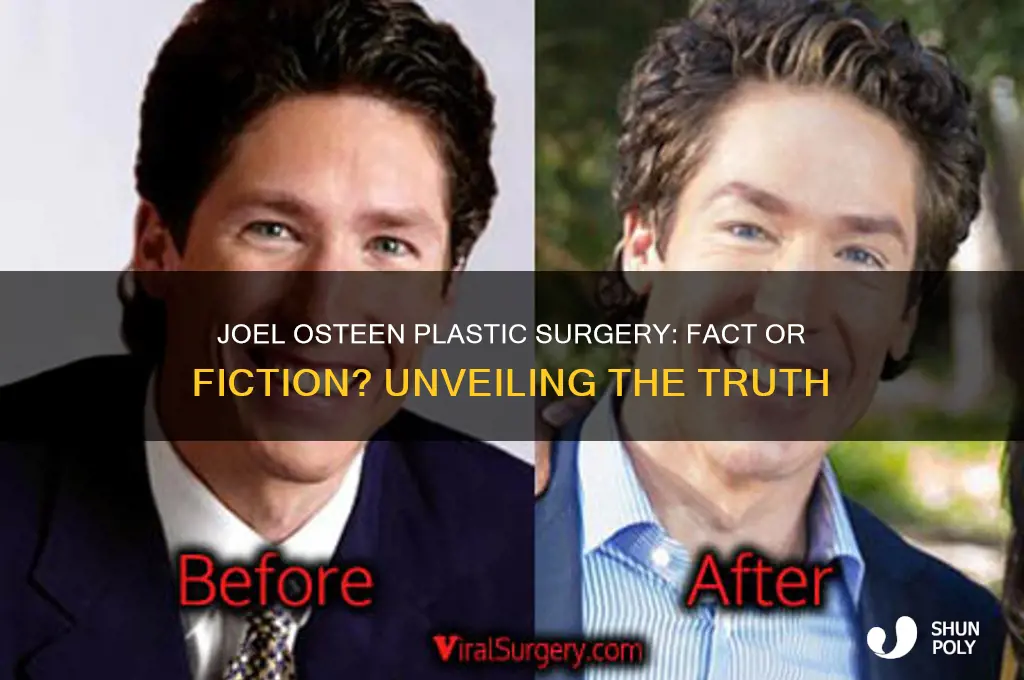 did joel osteen get plastic surgery