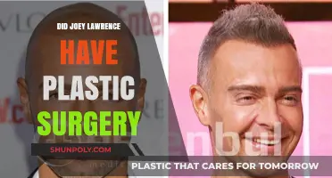 Joey Lawrence Plastic Surgery: Fact-Checking the Rumors and Speculations