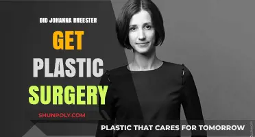 Johanna Breester's Transformation: Plastic Surgery Speculations and Truths