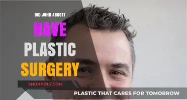 John Abbott's Transformation: Plastic Surgery Rumors Explored and Debunked