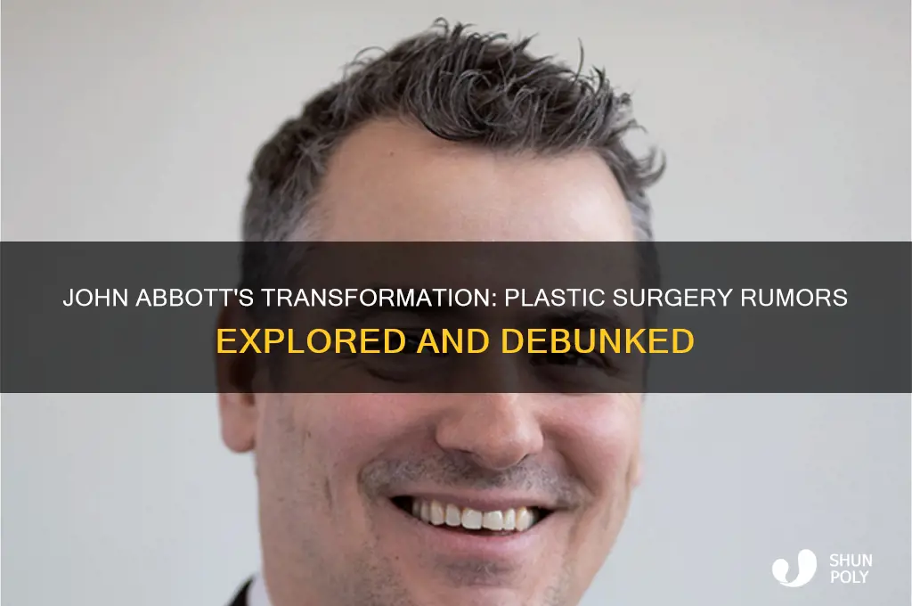 did john abbott have plastic surgery