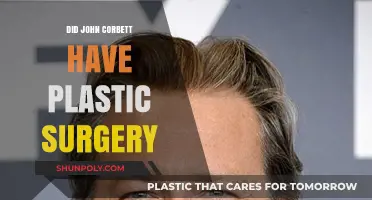 John Corbett's Transformation: Plastic Surgery Rumors Explored and Debunked