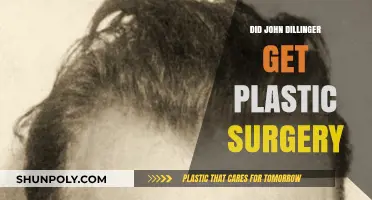 John Dillinger's Face: Plastic Surgery Rumors Explored and Debunked
