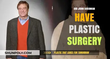 John Goodman's Transformation: Plastic Surgery Rumors Explored and Debunked