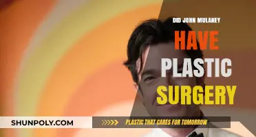 John Mulaney's Transformation: Plastic Surgery Rumors Explored and Debunked