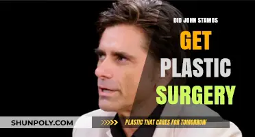 John Stamos Plastic Surgery: Fact-Checking the Rumors and Speculations