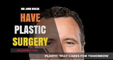 John Walsh's Transformation: Plastic Surgery Speculations and Truths Revealed