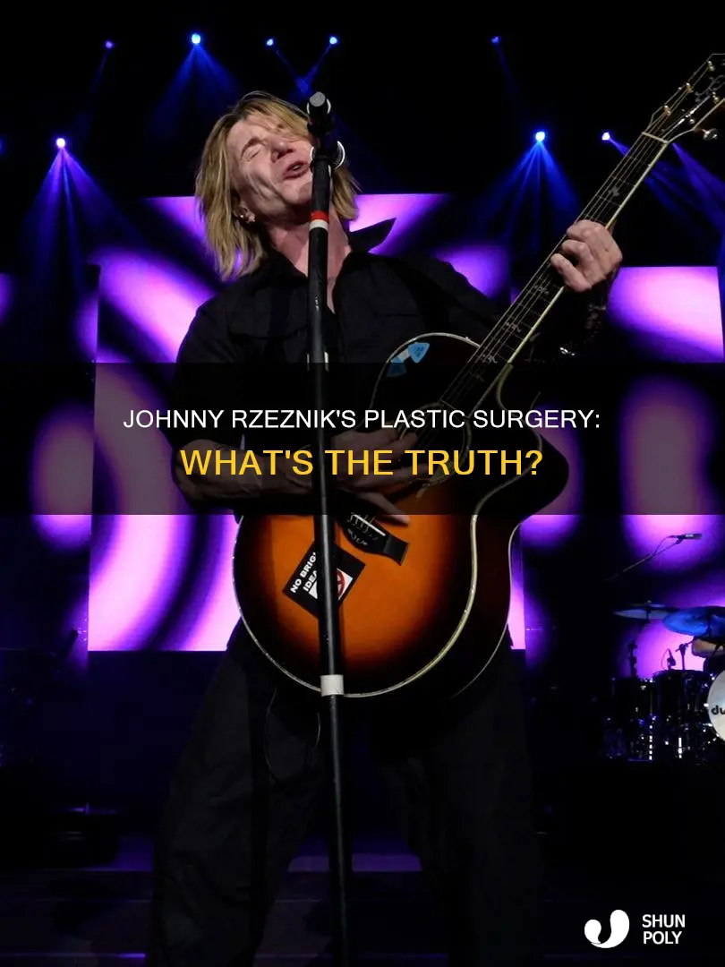 did johnny rzeznik have plastic sergery