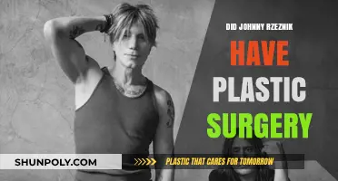 Johnny Rzeznik's Transformation: Plastic Surgery Rumors Explored