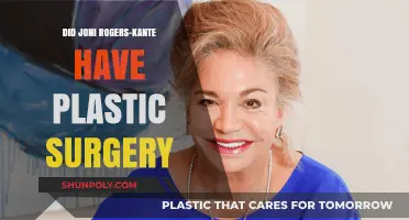 Joni Rogers-Kante's Transformation: Plastic Surgery Speculations Explored