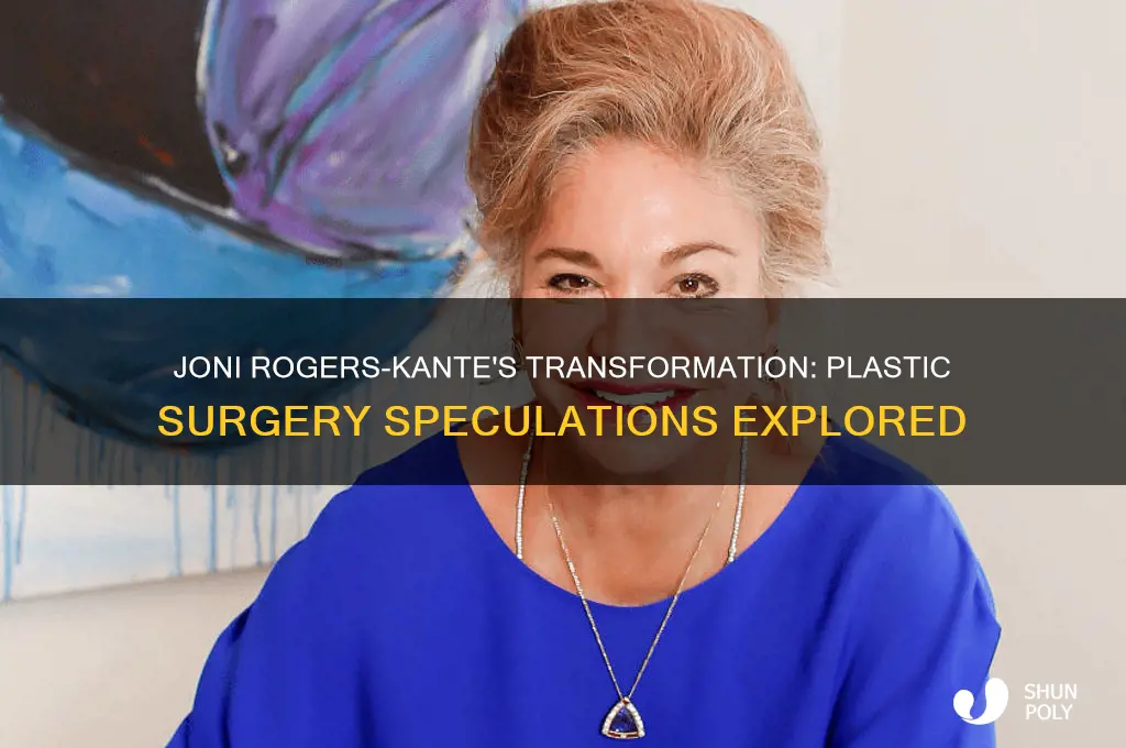 did joni rogers-kante have plastic surgery