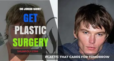 Jordan Barrett Plastic Surgery: Fact or Fiction? Unveiling the Truth