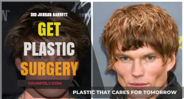 Jordan Barrett's Transformation: Plastic Surgery Rumors Explored and Debunked