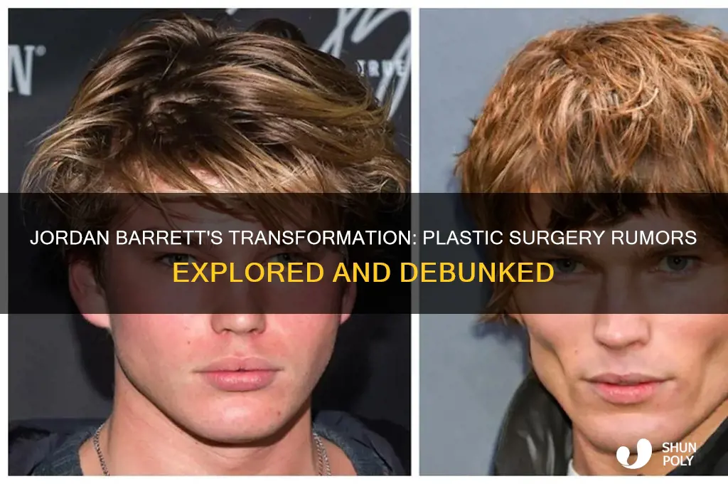 did jordan barrett get plastic surgery