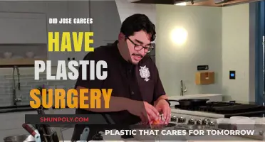 Jose Garces Plastic Surgery: Fact-Checking the Rumors and Speculations