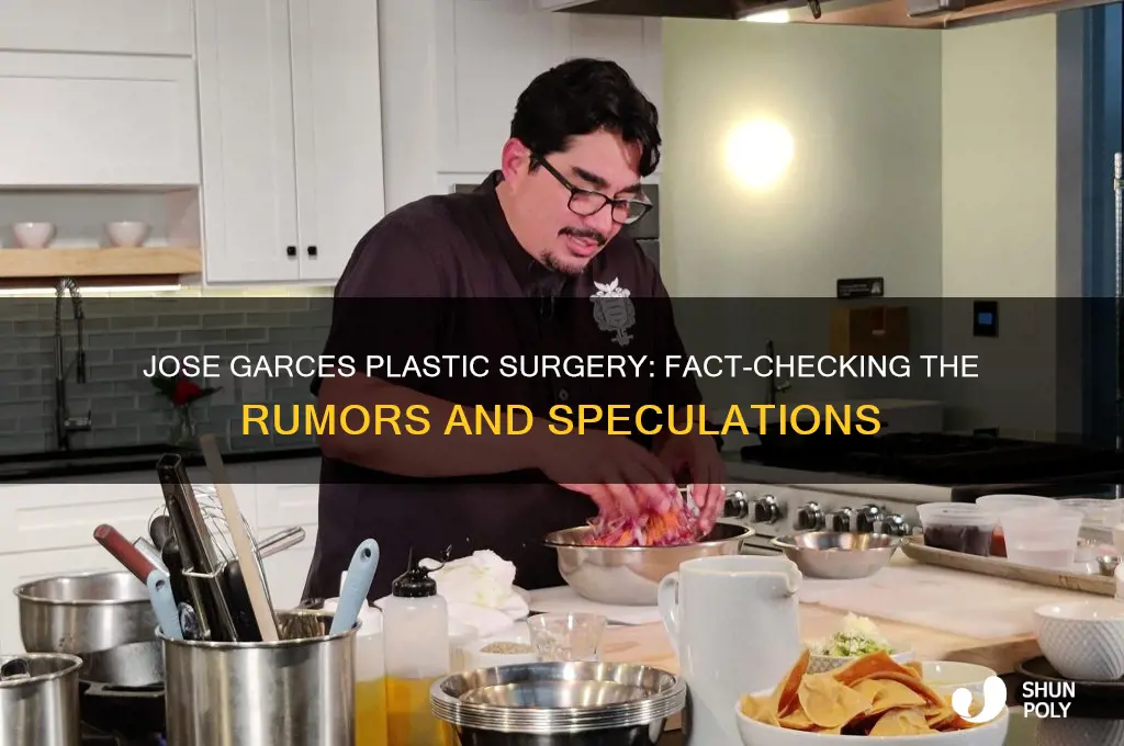 did jose garces have plastic surgery