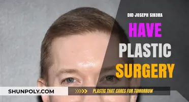 Joseph Sikora Plastic Surgery: Fact-Checking the Transformation Rumors