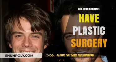 Josh Duhamel's Transformation: Plastic Surgery Rumors Explored and Debunked