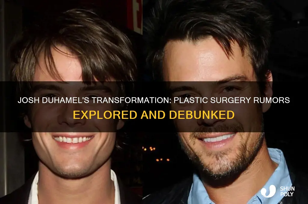 did josh duhamel have plastic surgery