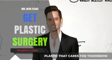 Josh Flagg Plastic Surgery: Fact-Checking the Rumors and Speculations