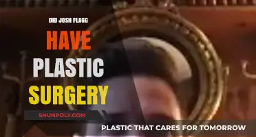 Josh Flagg Plastic Surgery: Fact-Checking the Rumors and Speculations