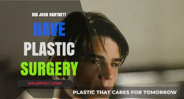 Josh Hartnett's Transformation: Plastic Surgery Rumors Explored