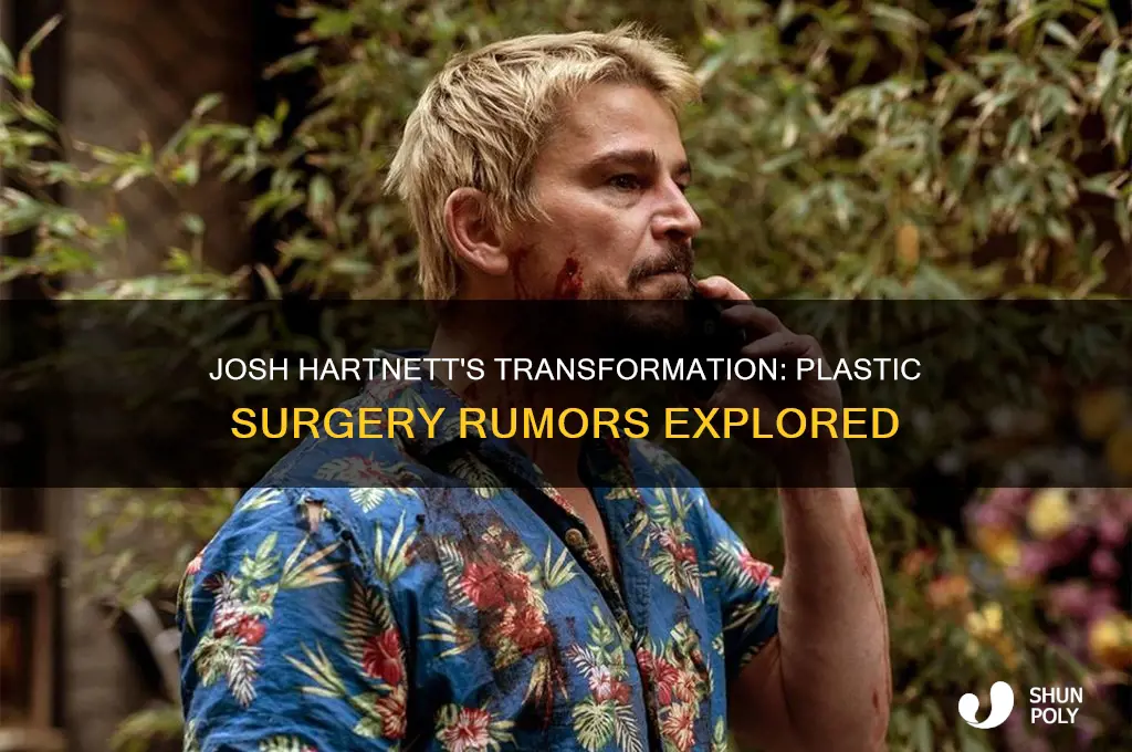 did josh hartnett have plastic surgery