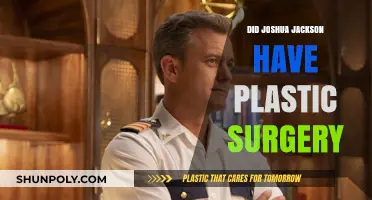Did Joshua Jackson Undergo Plastic Surgery? Unveiling the Truth