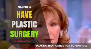 Joy Behar's Transformation: Plastic Surgery Speculations and Truths Revealed