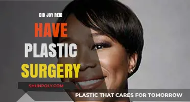 Joy Reid Plastic Surgery: Fact-Checking the Transformation Rumors