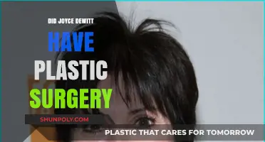 Joyce DeWitt Plastic Surgery: Fact-Checking the Actress' Transformation Rumors