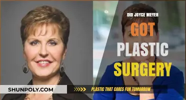 Joyce Meyer's Transformation: Plastic Surgery Rumors Explored and Debunked