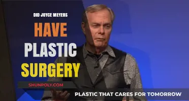 Joyce Meyer's Transformation: Plastic Surgery Speculations and Truths Revealed