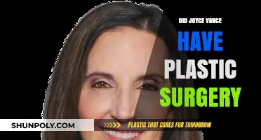 Joyce Vance Plastic Surgery: Fact-Checking the Rumors and Speculations