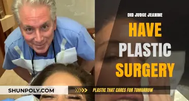 Judge Jeanine Pirro's Transformation: Plastic Surgery Speculations Explored