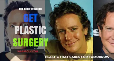 Judge Reinhold's Transformation: Plastic Surgery Speculations and Facts Revealed