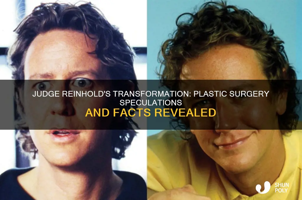 did judge reinhold get plastic surgery