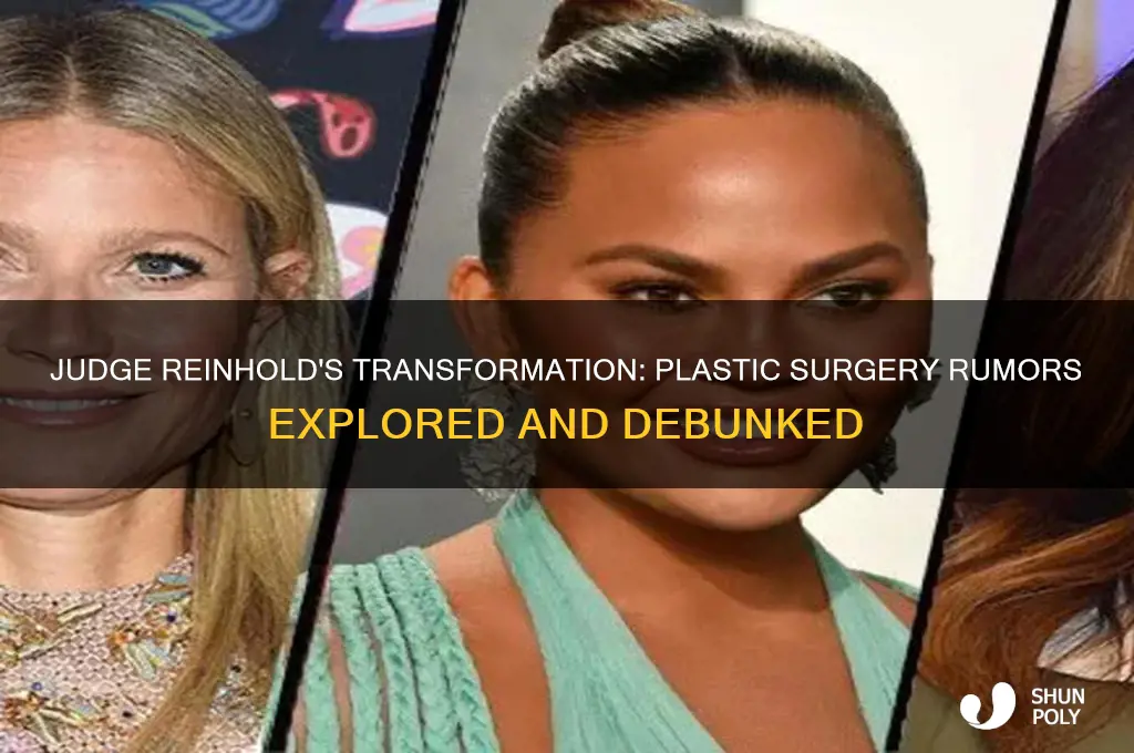 did judge reinhold have plastic surgery