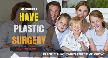 Judi Evans Plastic Surgery: Fact-Checking the Rumors and Speculations