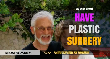 Judy Blume's Appearance: Plastic Surgery Speculations and Facts Revealed