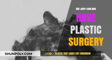 Judy Garland's Transformation: Uncovering the Truth About Plastic Surgery