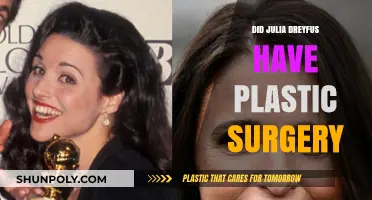 Julia Louis-Dreyfus Plastic Surgery: Fact-Checking the Rumors and Speculations