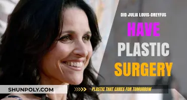 Julia Louis-Dreyfus Plastic Surgery: Fact-Checking the Rumors and Speculation