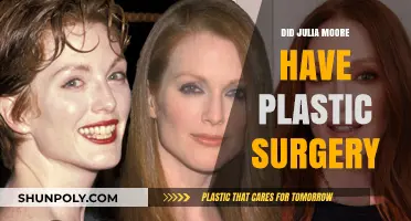 Julia Moore's Transformation: Plastic Surgery Speculations and Truths
