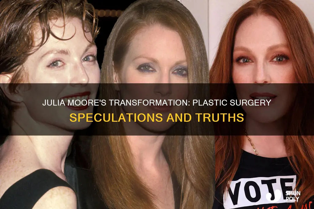 did julia moore have plastic surgery