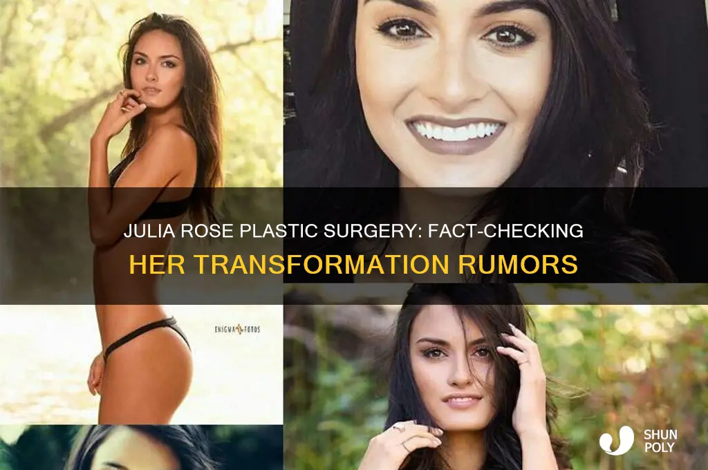 did julia rose get plastic surgery