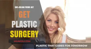 Julian AGT Plastic Surgery: Fact-Checking Transformation Rumors and Truths